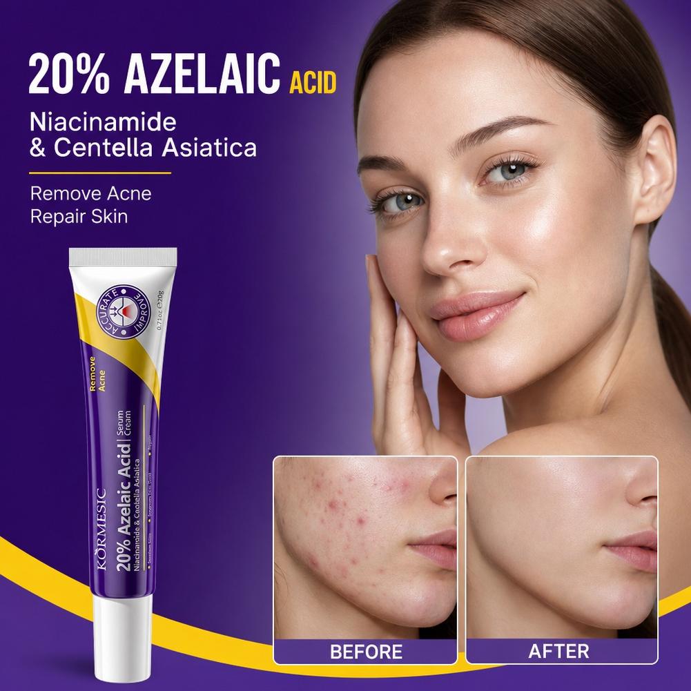 20% 아젤라산 에센스 딥 모이스처라이징 페이셜 케어  - Luxury Skincare Brands 리뷰 및 가격